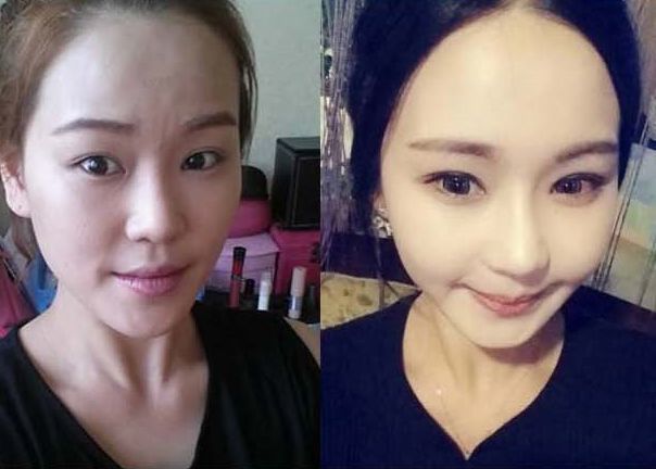 Ms.Charming’s Plastic Surgery Real Review