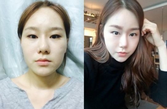 Mimi’s Plastic Surgery Real Review