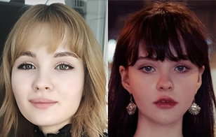 Elga’s Plastic Surgery Real Review.