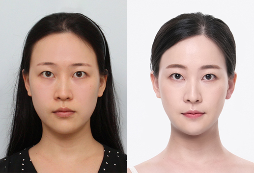 Doa’s Plastic Surgery Real Review.