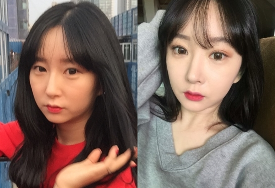 QuQu’s Plastic Surgery Real Review