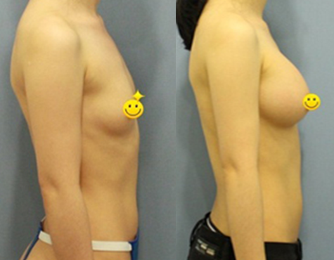 Shonny’s Plastic Surgery Real Review