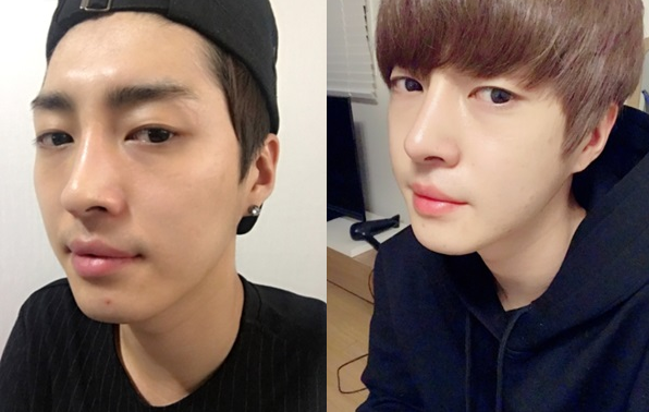 JinJin’s Plastic Surgery Real Review