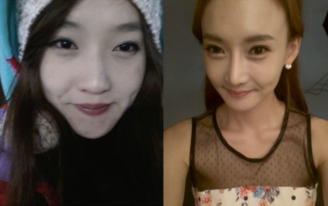 Yuri’s Plastic Surgery Real Review